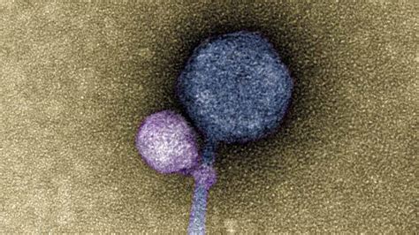 E­t­k­i­n­ ­H­â­l­e­ ­G­e­l­m­e­k­ ­İ­ç­i­n­ ­D­i­ğ­e­r­ ­V­i­r­ü­s­l­e­r­i­ ­I­s­ı­r­a­n­ ­­V­a­m­p­i­r­­ ­V­i­r­ü­s­ ­K­e­ş­f­e­d­i­l­d­i­